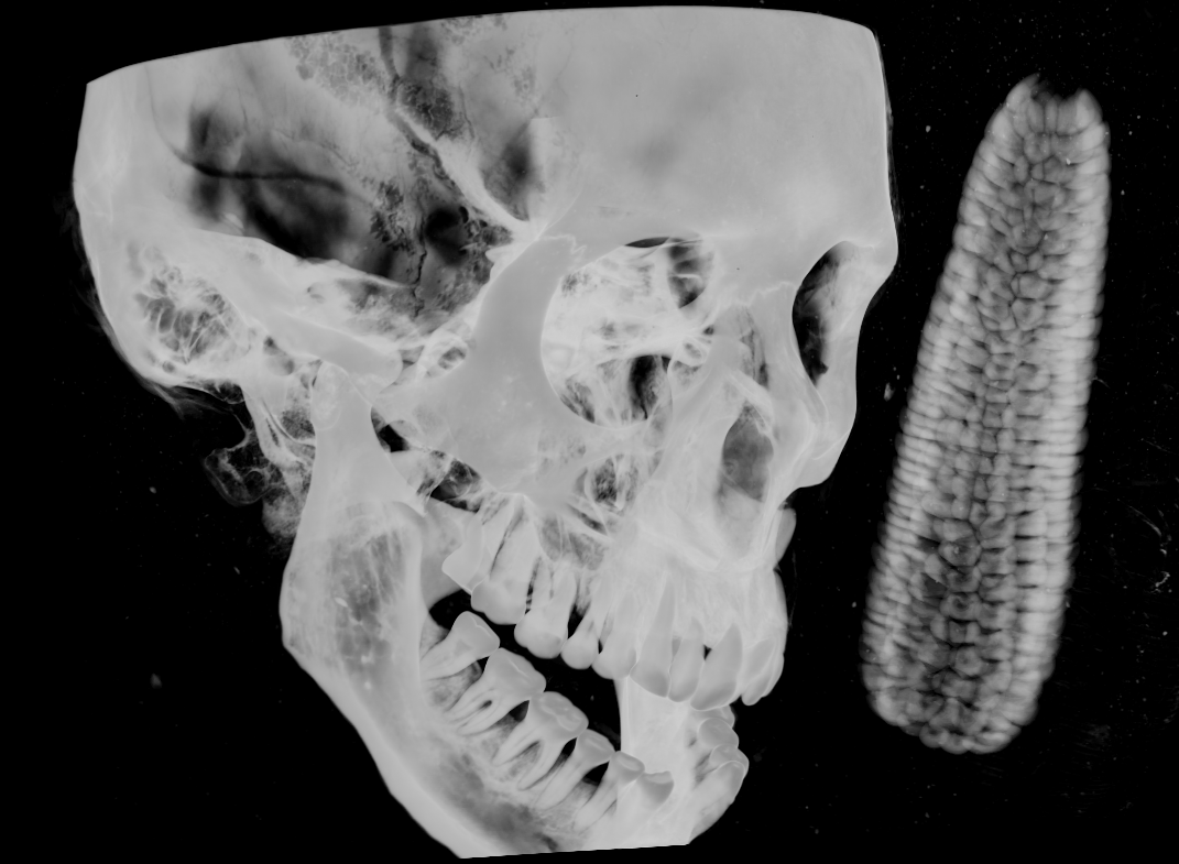3D-Röntgencomputertomographie einer peruanischen Mumie