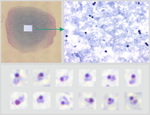 SCube® Overall Scan Thick Blood Smear
