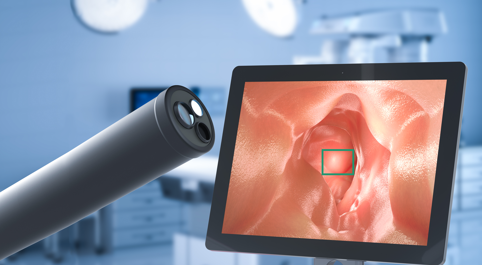Intelligente Endoskopie – KI-basierte Polypendetektion während der Koloskopie