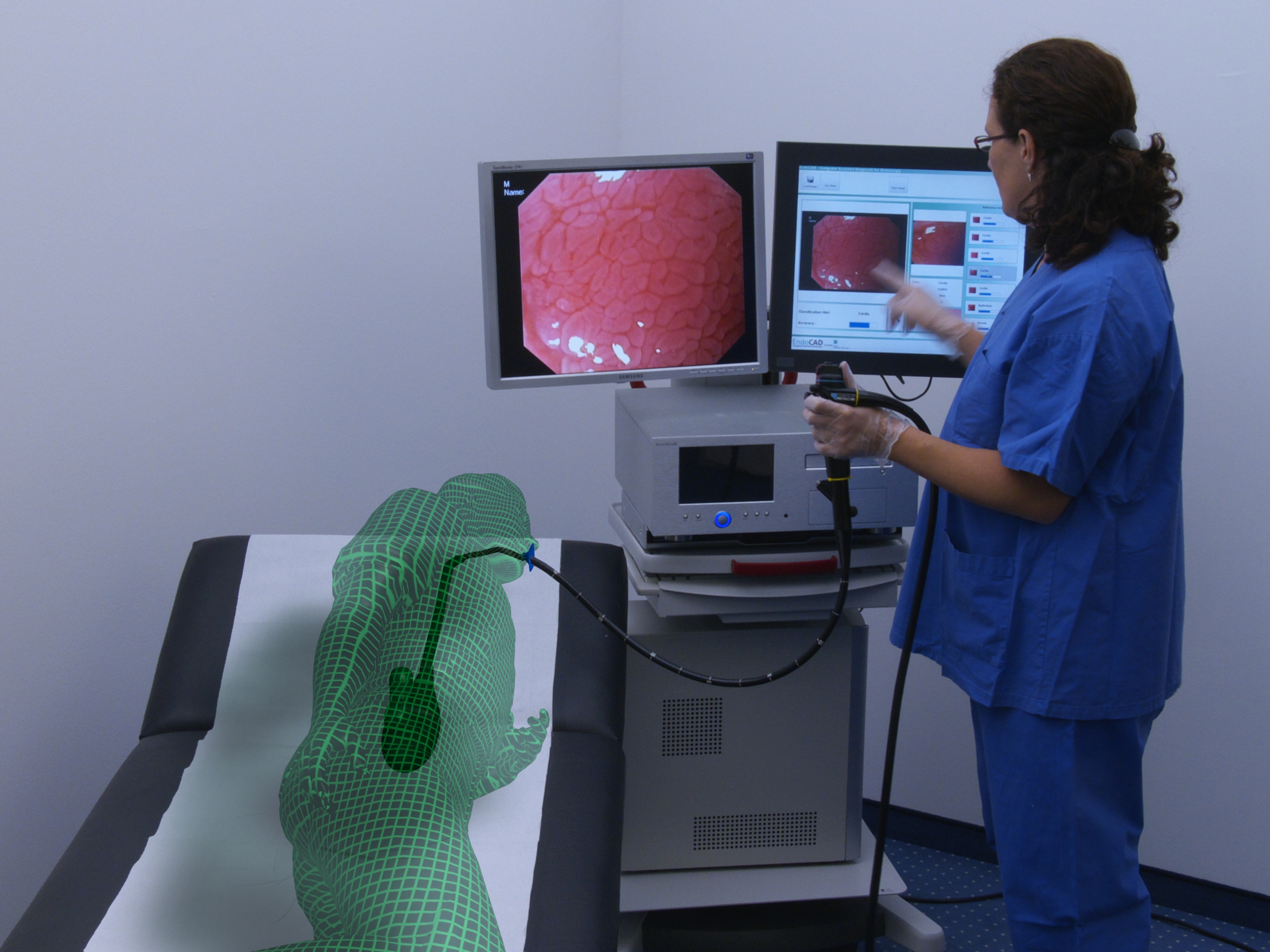 EndoCAD® - Computer-assistierte Diagnose für die Endoskopie