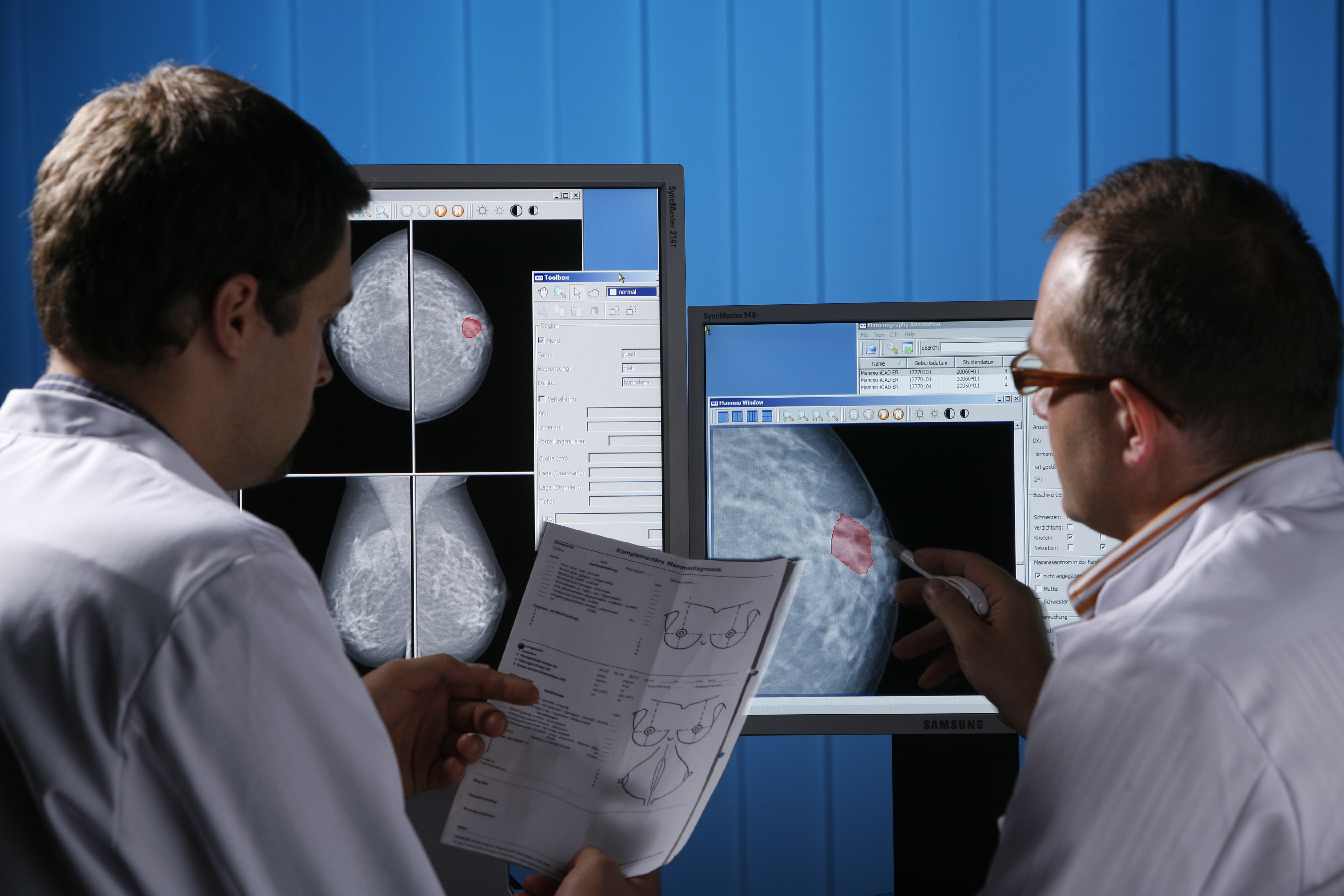 Radiologie Mammographie MammoCAD