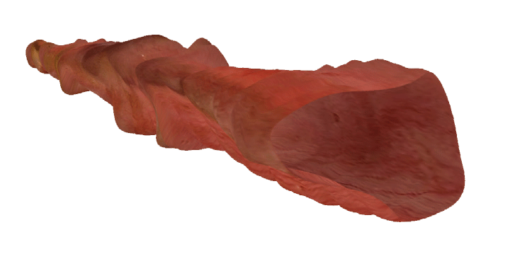 TubeStitcher - Panorama-Darstellung der Speiseröhre