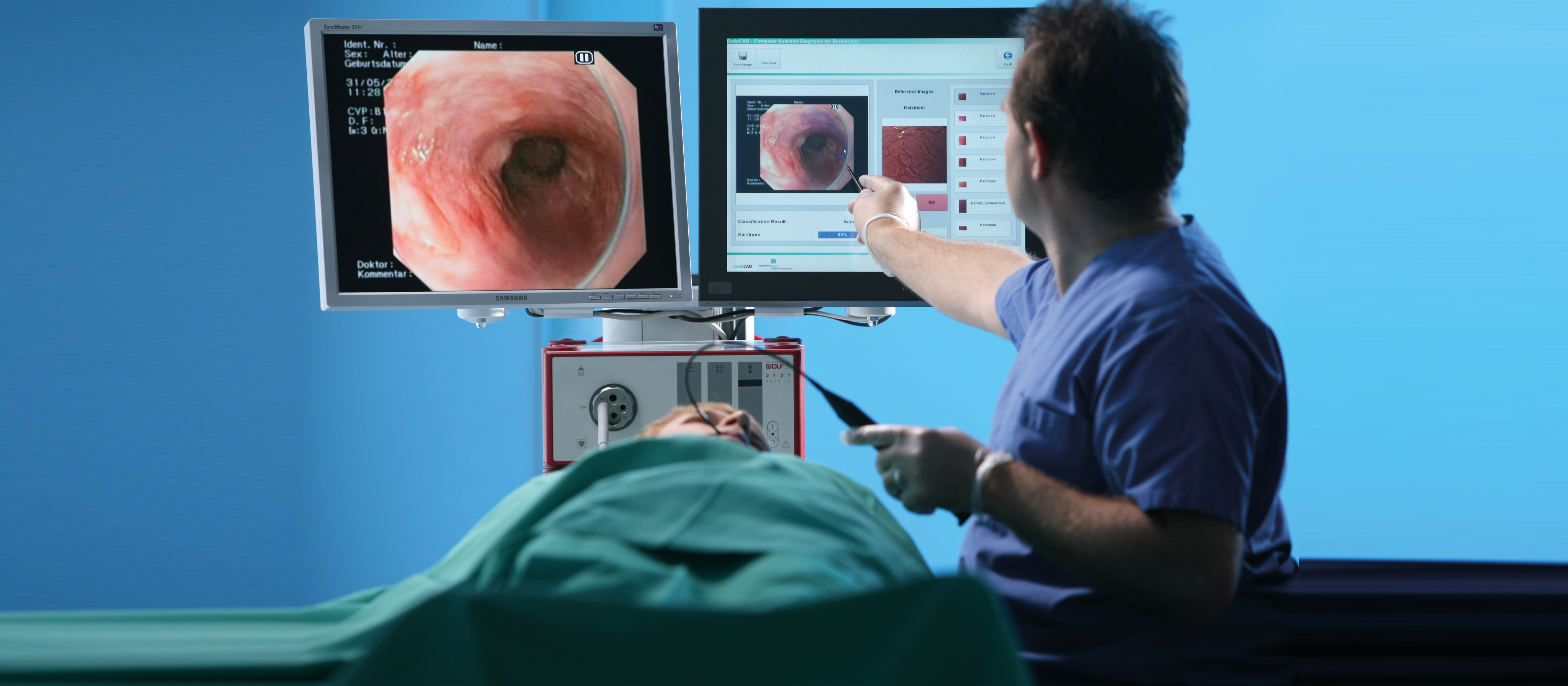 EndoCAD® – Computer-assisted Diagnosis for Endoscopy