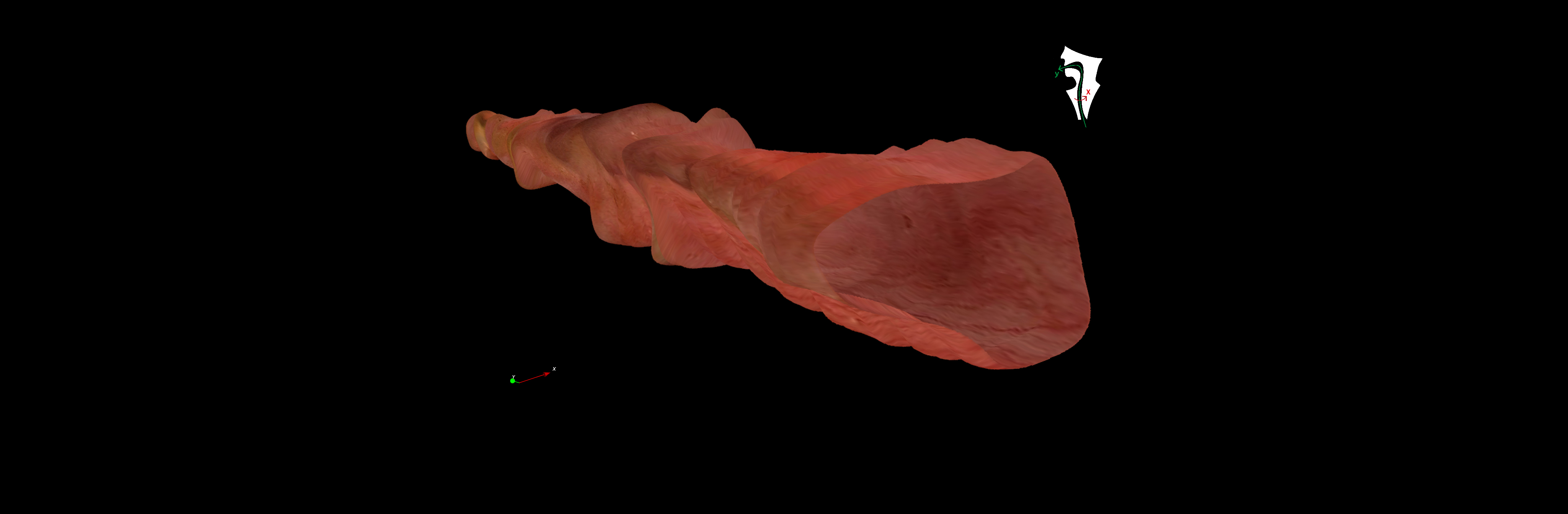 TubeStitcher – Panoramic Mapping of the Esophagus